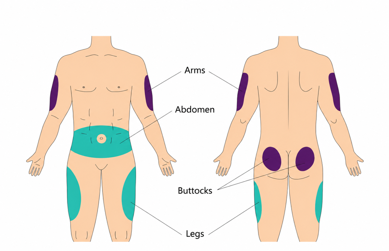 Adult body diagram showing four approved injection sites: upper arms, abdomen, buttocks, and outer thighs